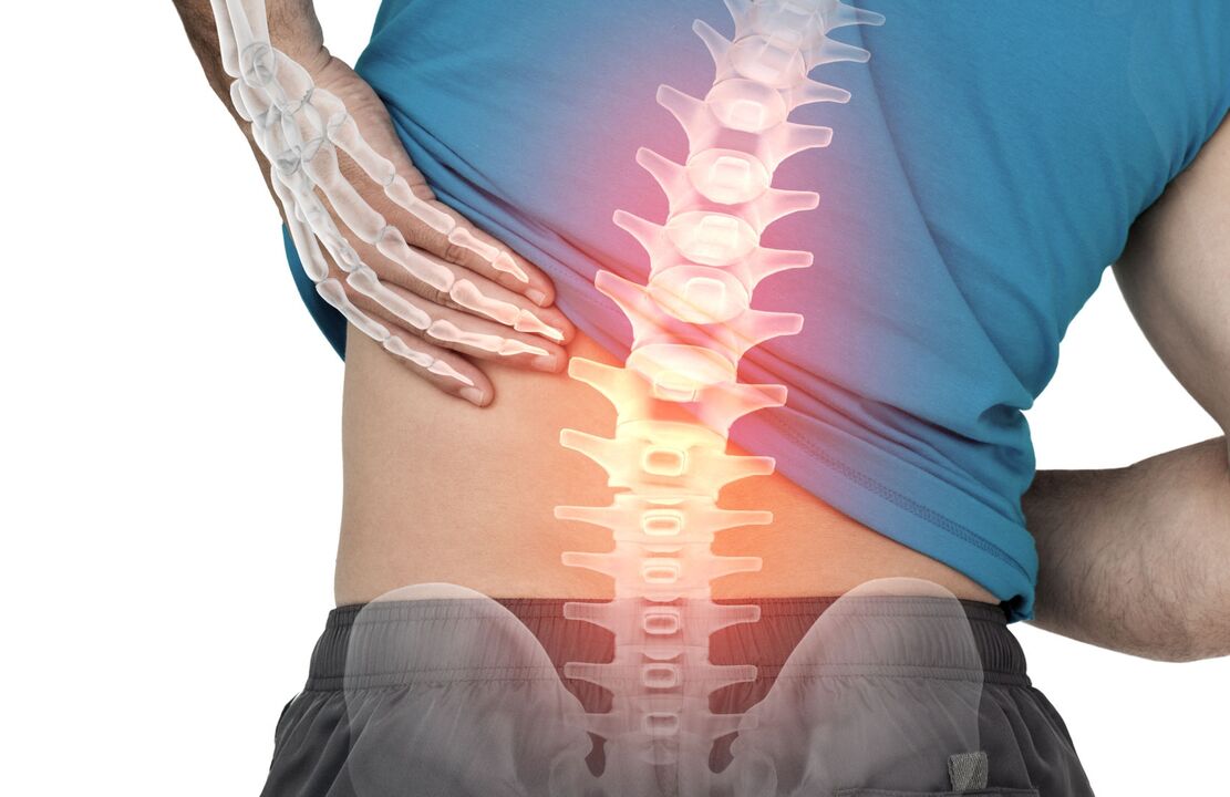 Opasnost od ostekondroze lumbara