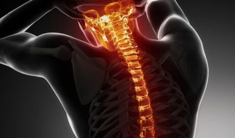 Osteohondroza cijele kralježnice