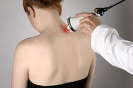 Liječenje cervikalne osteohondroze laserskom terapijom