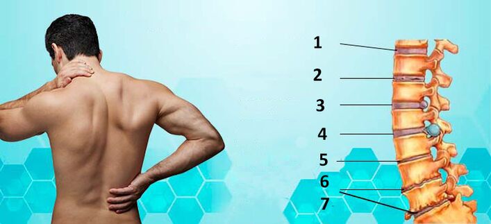 faze razvoja osteohondroze